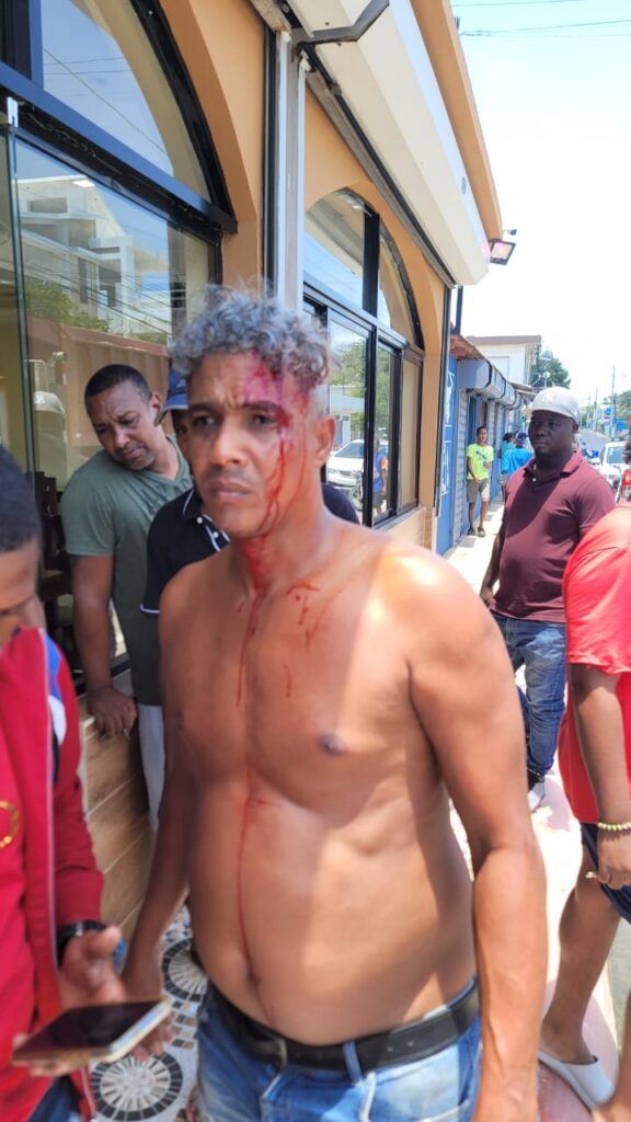 eL LLAMADO sANTIGO cAPITAN DE LA LANCHA RAPIDA RESULTA HERIDO CON GOLPE DE LA PISTOLA DE UNO DE LOS SUSPUESTOS ATRACADORES